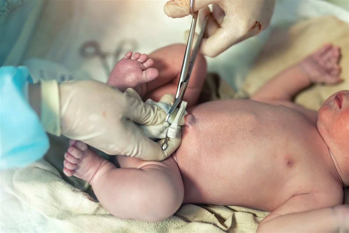 Sets de soin du cordon : quel impact sur la guérison du nombril de bébé ?
